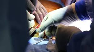غیر ملکیوں کو گردے فروخت کرنے والے گینگ کیخلاف شہری کے اغوا کا مقدمہ درج