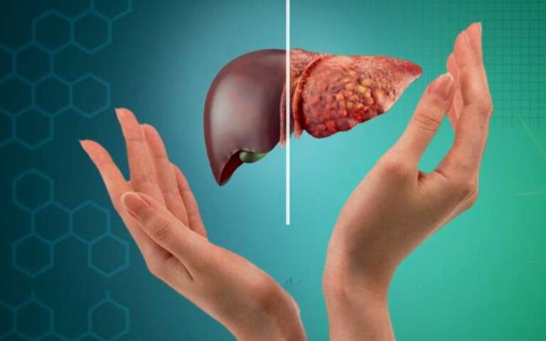 خواتین میں 45 سال کے بعد جگر میں چربی بڑھنے کی وجہ سامنے آگئی