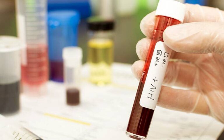 پاکستان میں ایچ آئی وی عام آبادی تک پہنچ گیا، متاثرہ افراد کی تعداد 3 لاکھ 70 ہزار ہوگئی